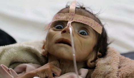 اليمن على حافة مجاعة مرعبة